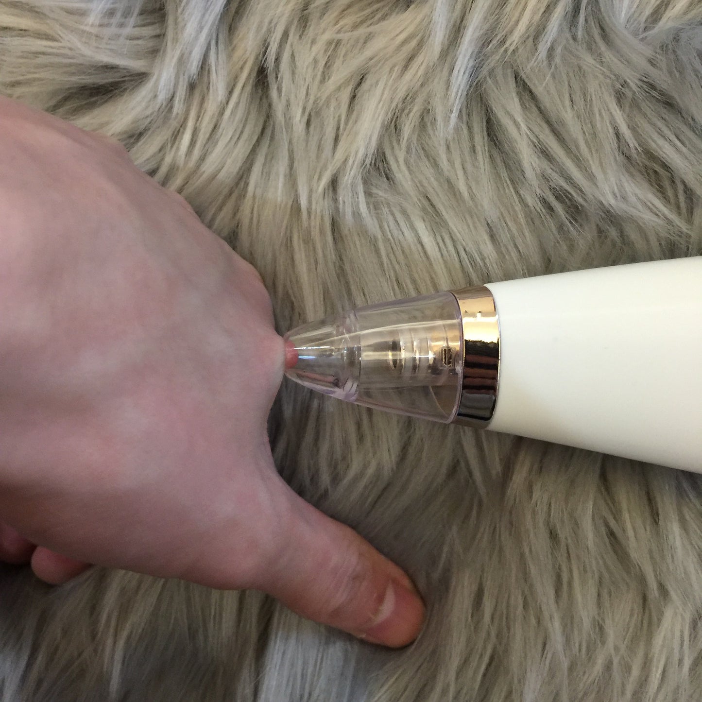 Blackhead Suction Instrument